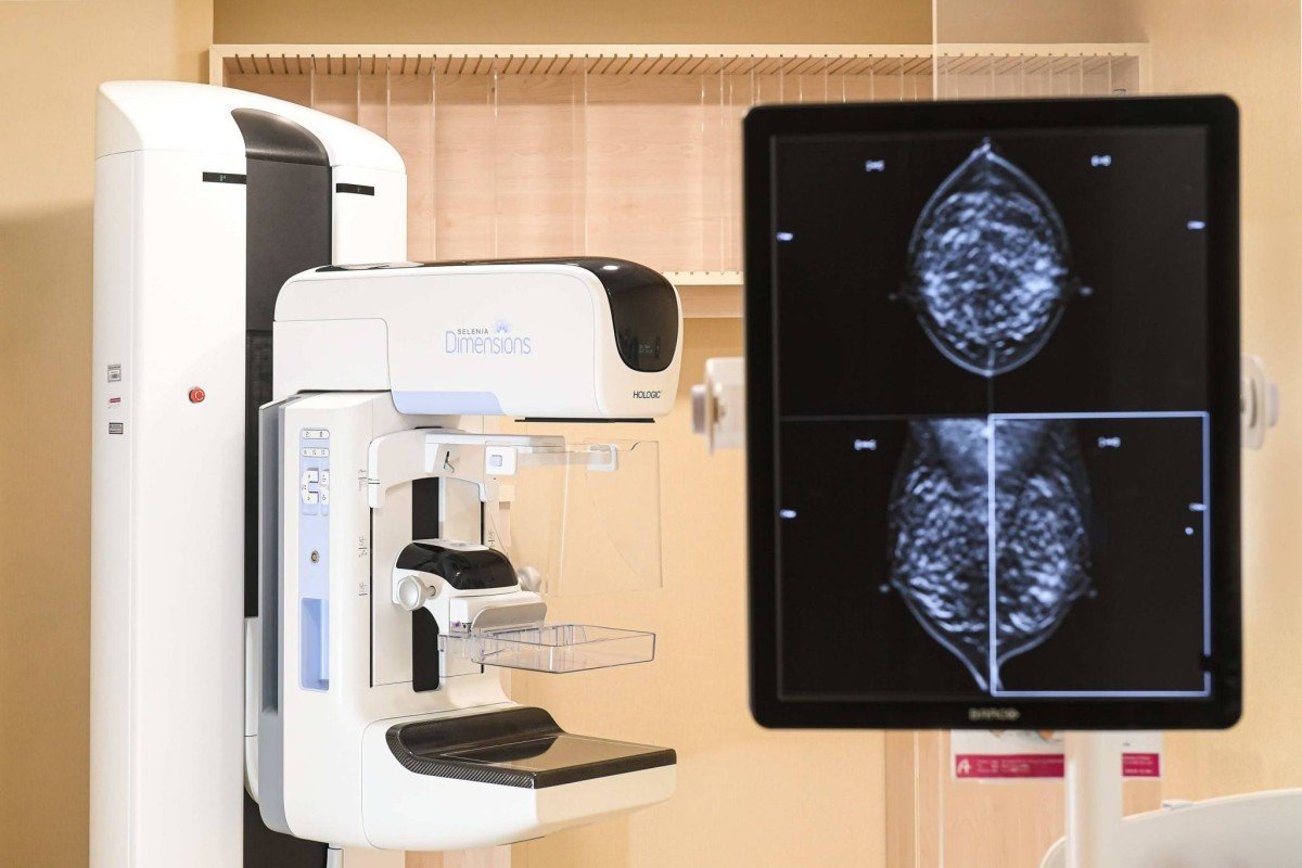 3D Mammogram Main